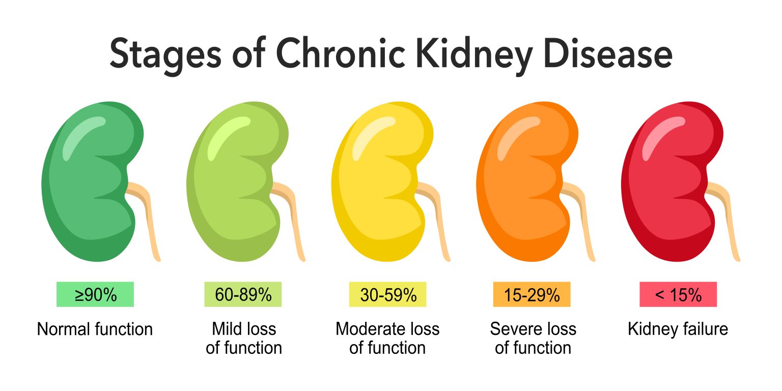 Stages of CKD - Renes Care